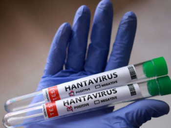 Zavod za javno zdravstvo KS izdao preporuke za zaštitu od hantavirusa