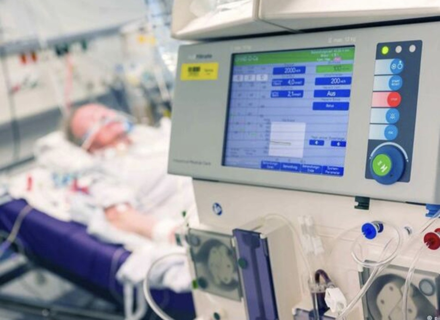Afera "respiratori" u Mađarskoj: Prevara teška 826 miliona eura - slika 1