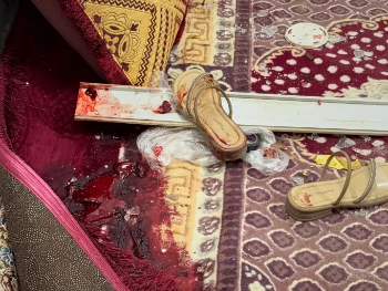U američkim napadima na Iran ranjeno 105 žena i djece