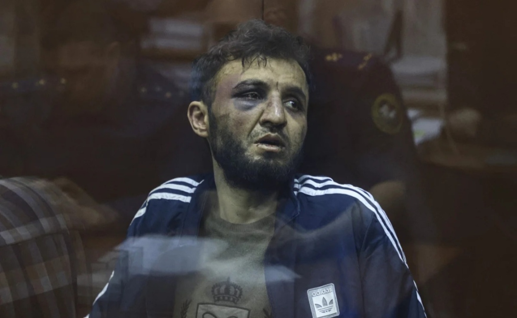 Vidljivi tragovi brutalnog mučenja na napadačima - slika 1