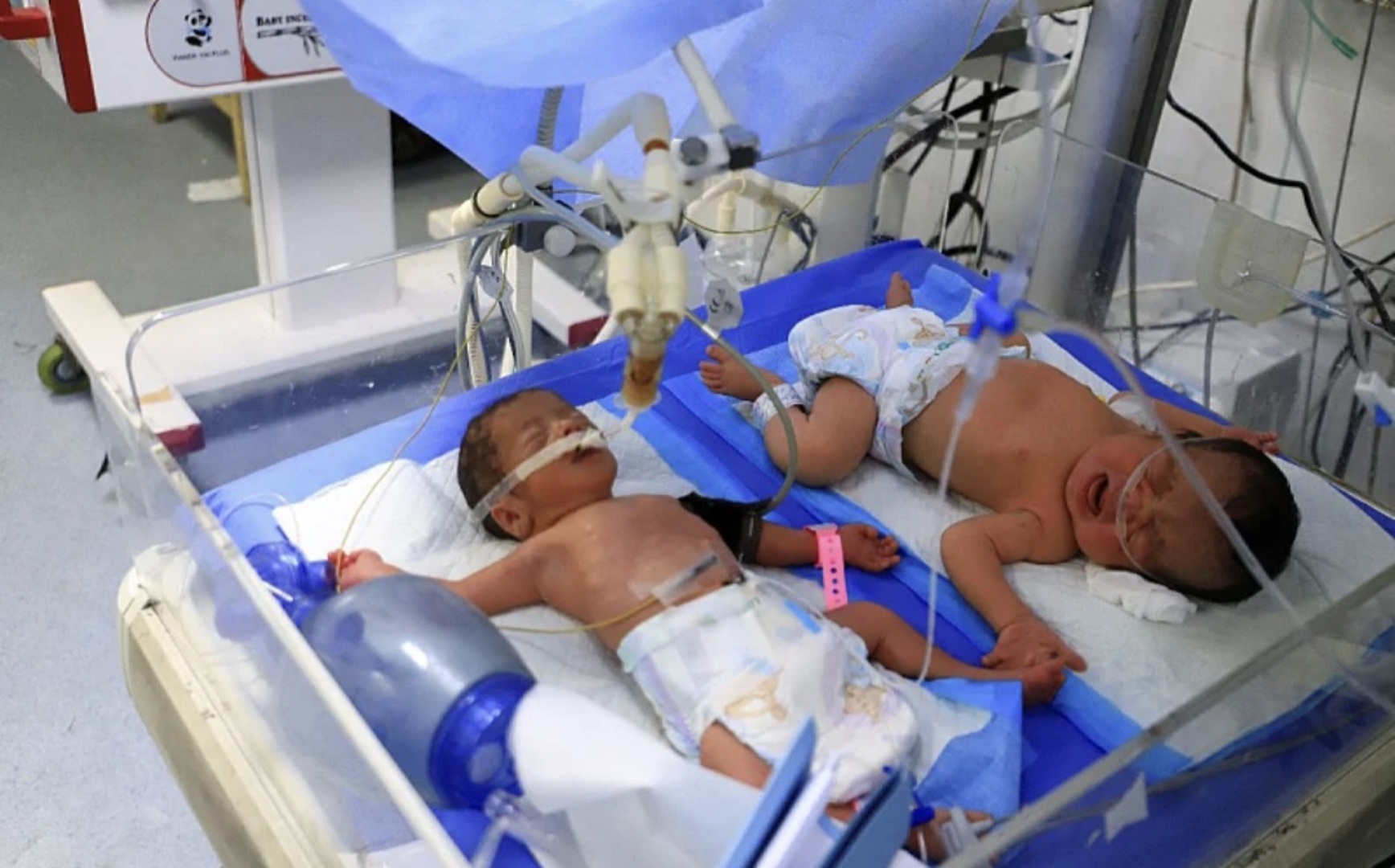 Dvije bebe u Gazi umrle zbog nedostatka dohrane - slika 1