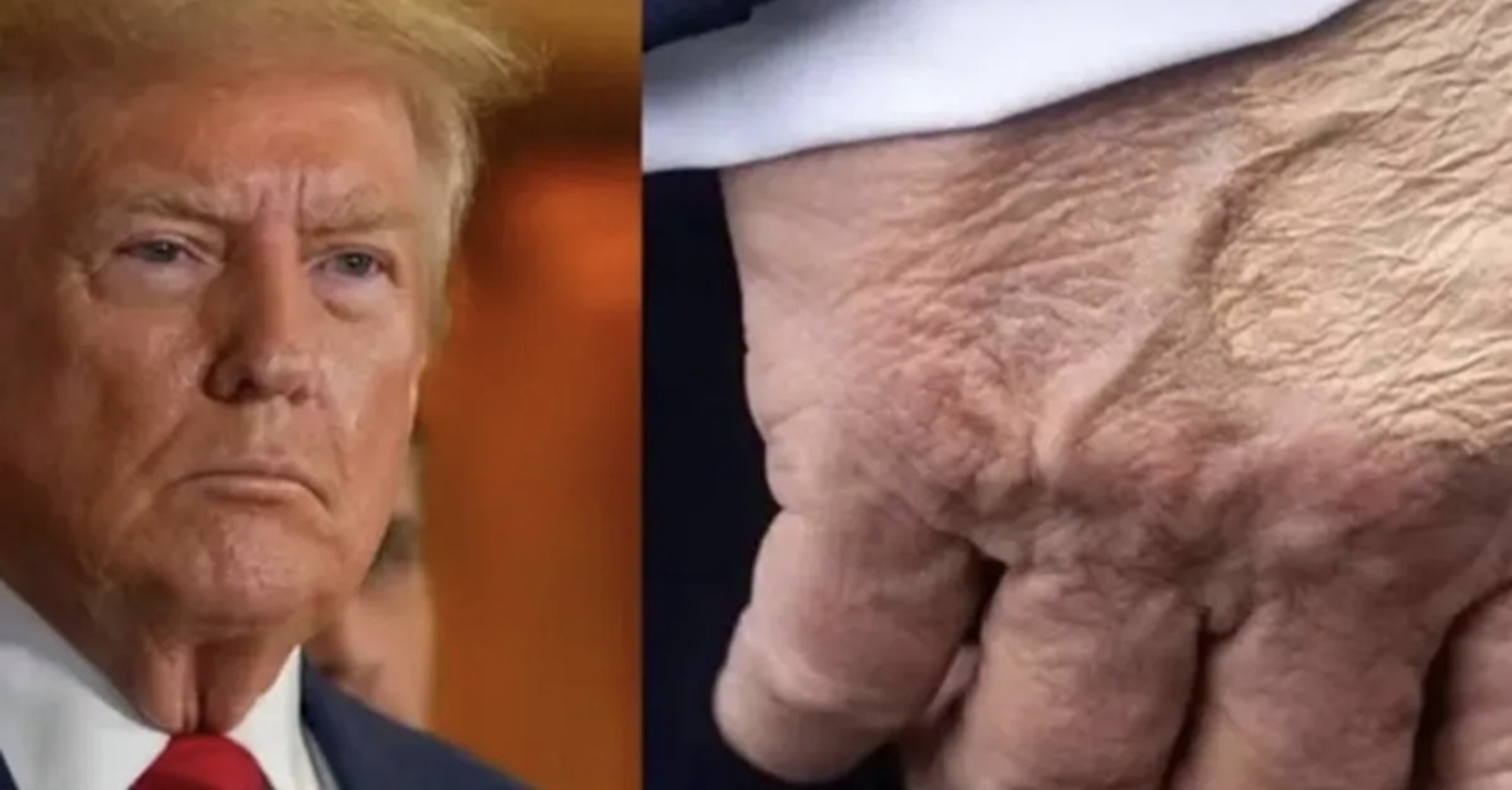 Poznato od čega boluje Trump - slika 1