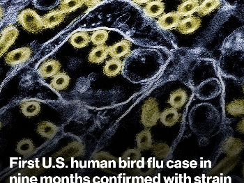 Nova verzija ptičije gripe pronađena kod čovjeka