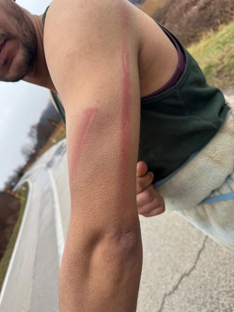 Migranti u Hrvatskoj brutalno pretučeni i prebačeni u BiH - slika 3