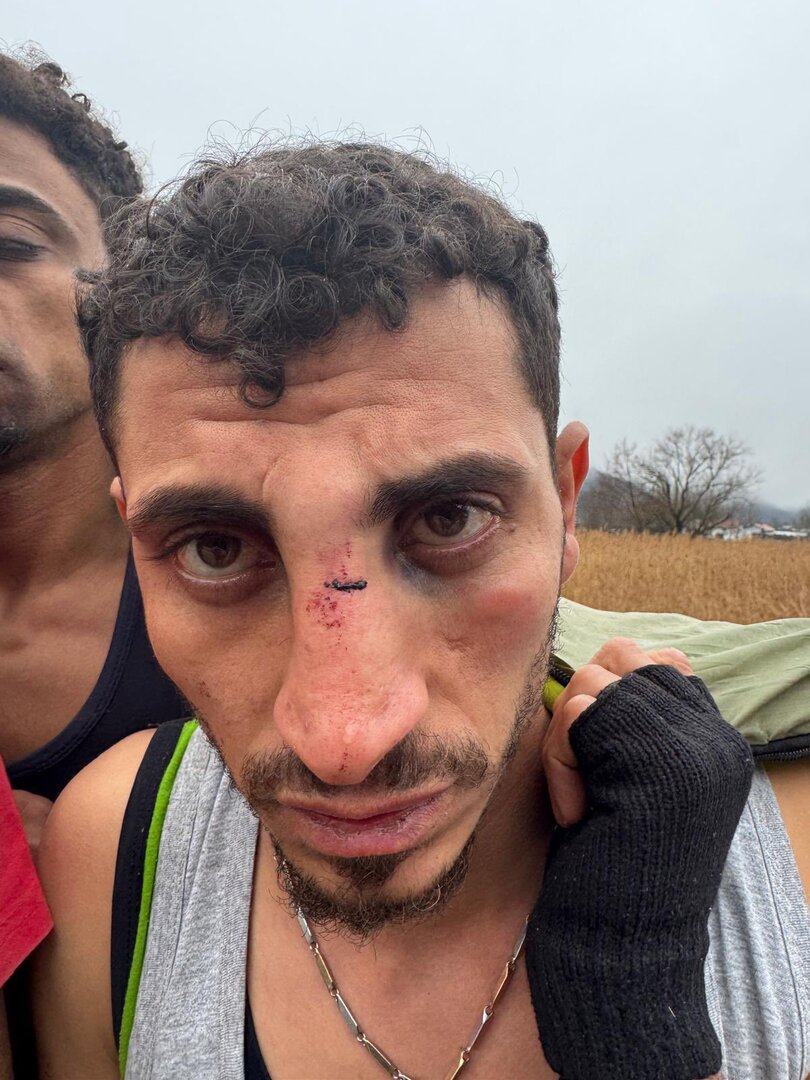 Migranti u Hrvatskoj brutalno pretučeni i prebačeni u BiH - slika 4