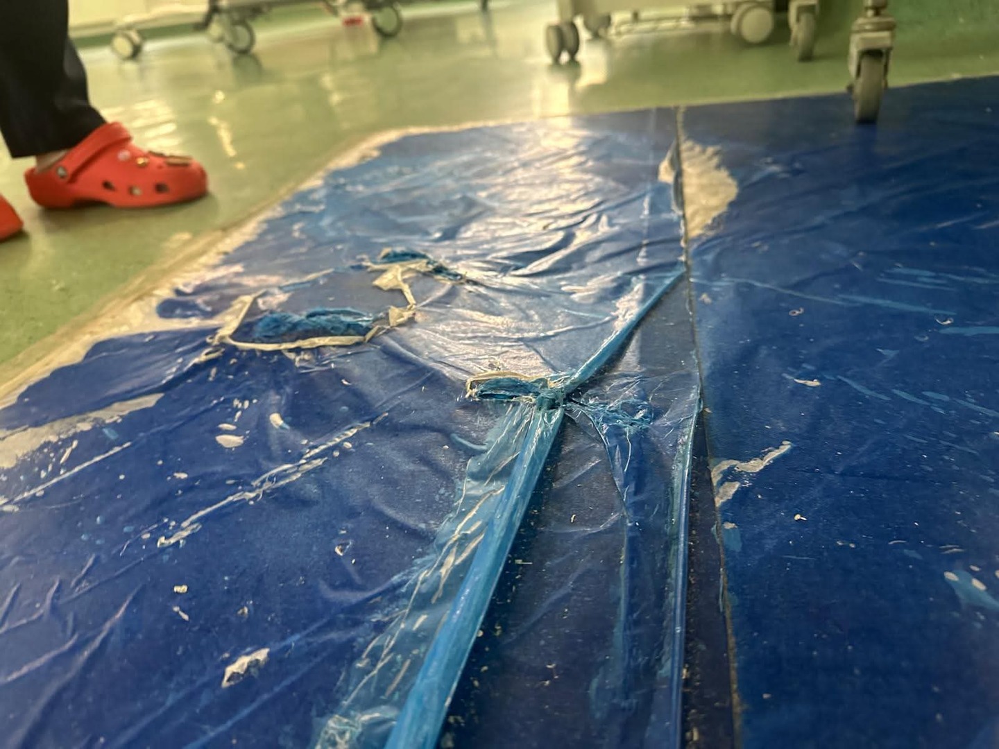 Pilav: KCUS je bolnica, a ne štedionica  - slika 11